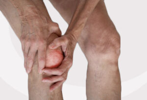 Exercises-for-coping-with-osteoarthritis-org