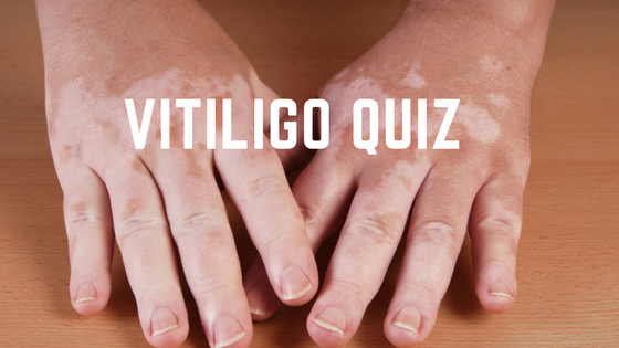 Vitiligo Quiz