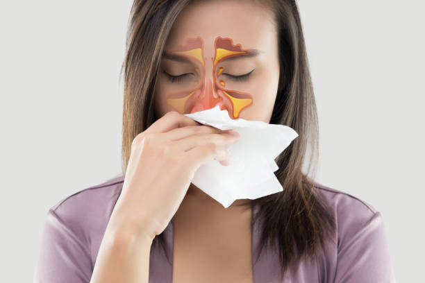 Allergic Rhinitis