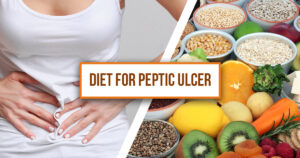 Diet for Peptic Ulcer