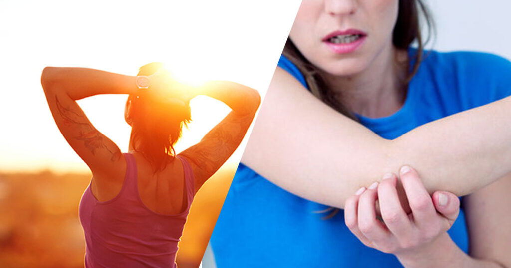 Sunlight exposure to cure eczema