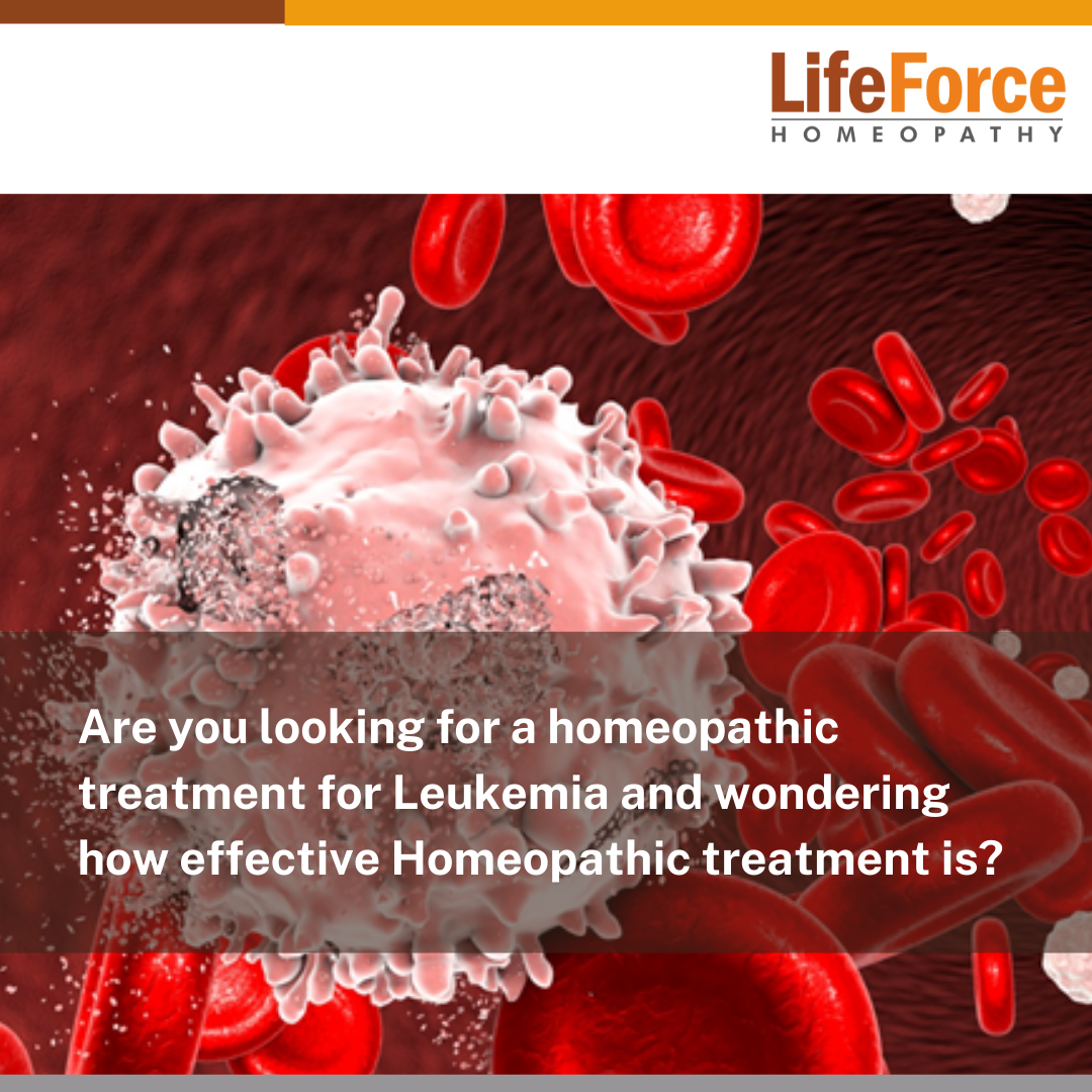 Learn All About Homeopathy For Leukemia - Can Leukemia Be Treated With Natural Remedies