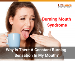 Burning Mouth Syndrome