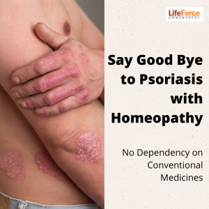 Homeopathy for Psoriasis