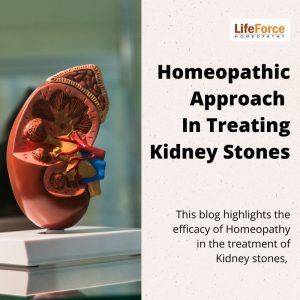 homeopathy treatment for kidney stone