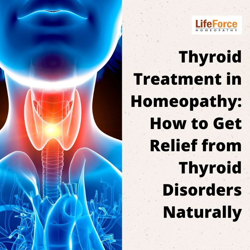 Thyroid Treatment in Homeopathy