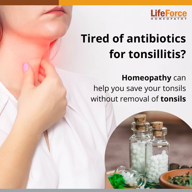 Tired of antibiotics for tonsillitis? Homeopathy can help you save your tonsils without removal of tonsils