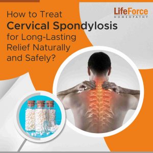 Cervical spondylosis can be painful, but relief is possible. Natural treatments for cervical spondylosis such as lifestyle modifications, exercise, and holistic remedies can provide long-lasting relief.