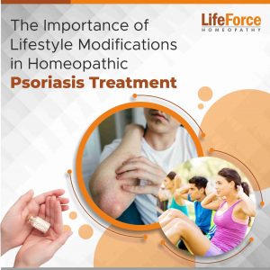 The Importance of Lifestyle Modifications in Homeopathic Psoriasis Treatment