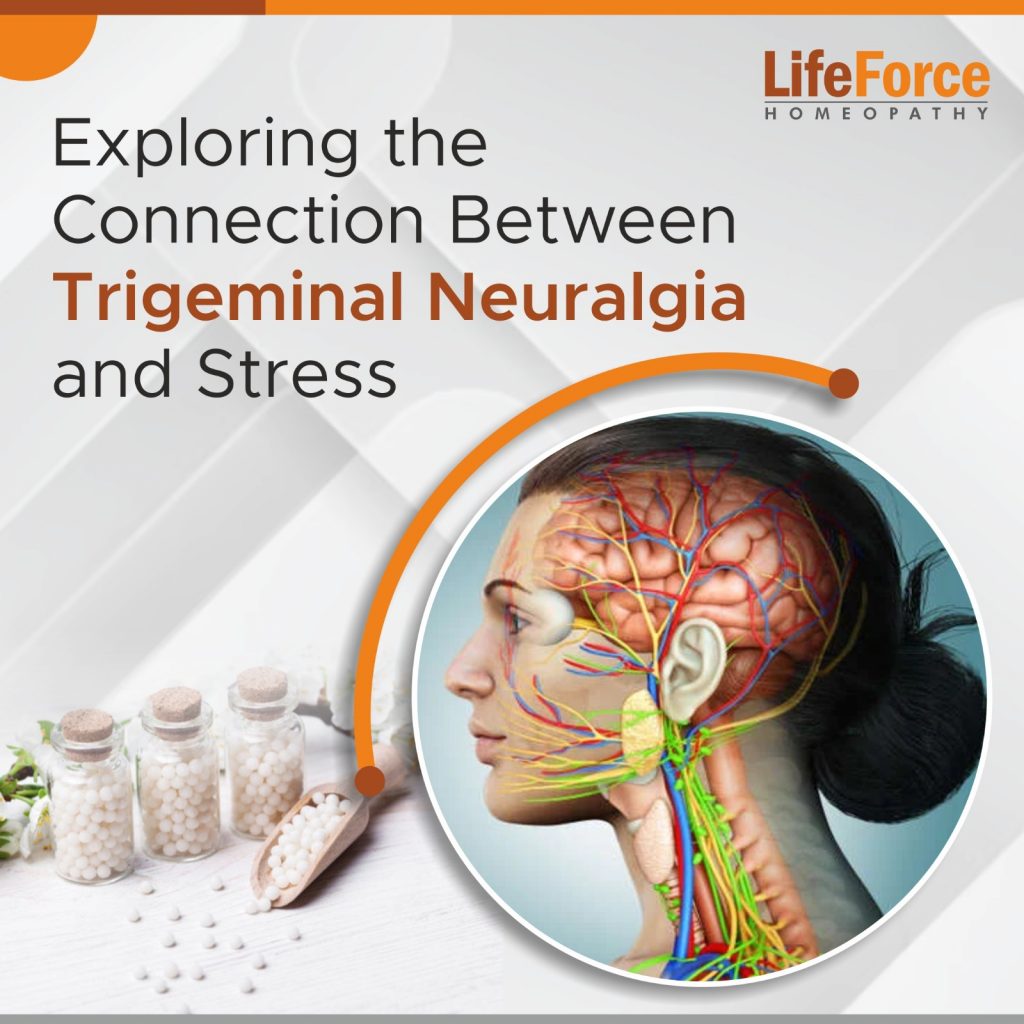 Exploring the Connection Between Trigeminal Neuralgia and Stress