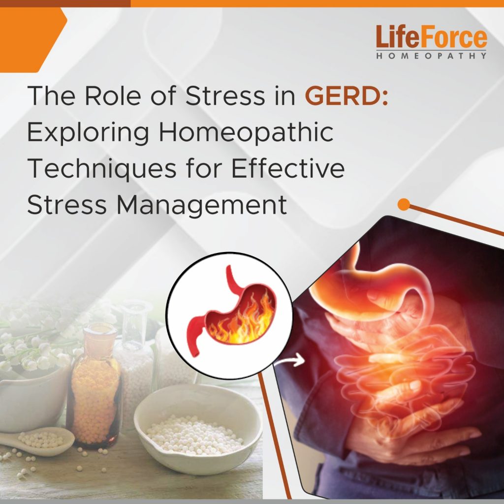 The Role of Stress in GERD: Exploring Homeopathic Techniques for Effective Stress Management