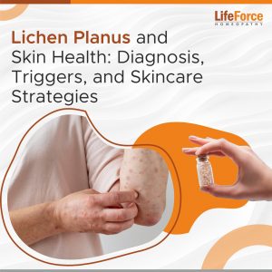 Lichen Planus and Skin Health: Diagnosis, Triggers, and Skincare Strategies