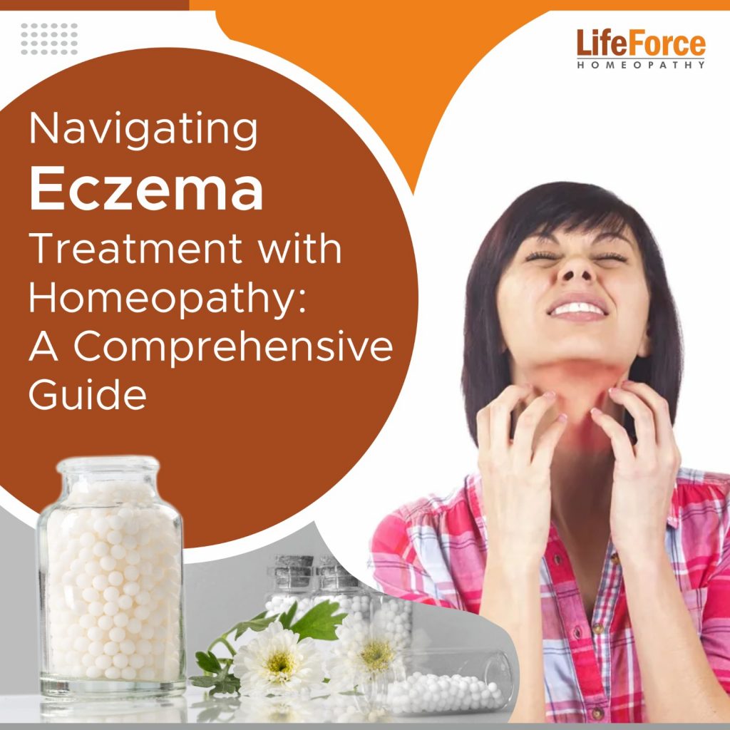 Navigating Eczema Treatment with Homeopathy: A Comprehensive Guide