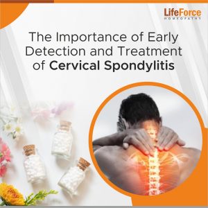 The Importance of Early Detection and Treatment of Cervical Spondylitis