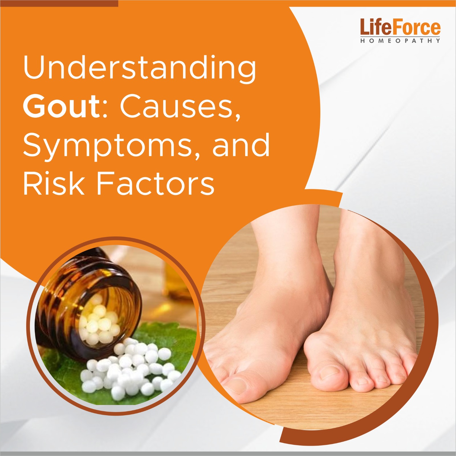 Gout Simplified, What Causes it and Signs to Watch For