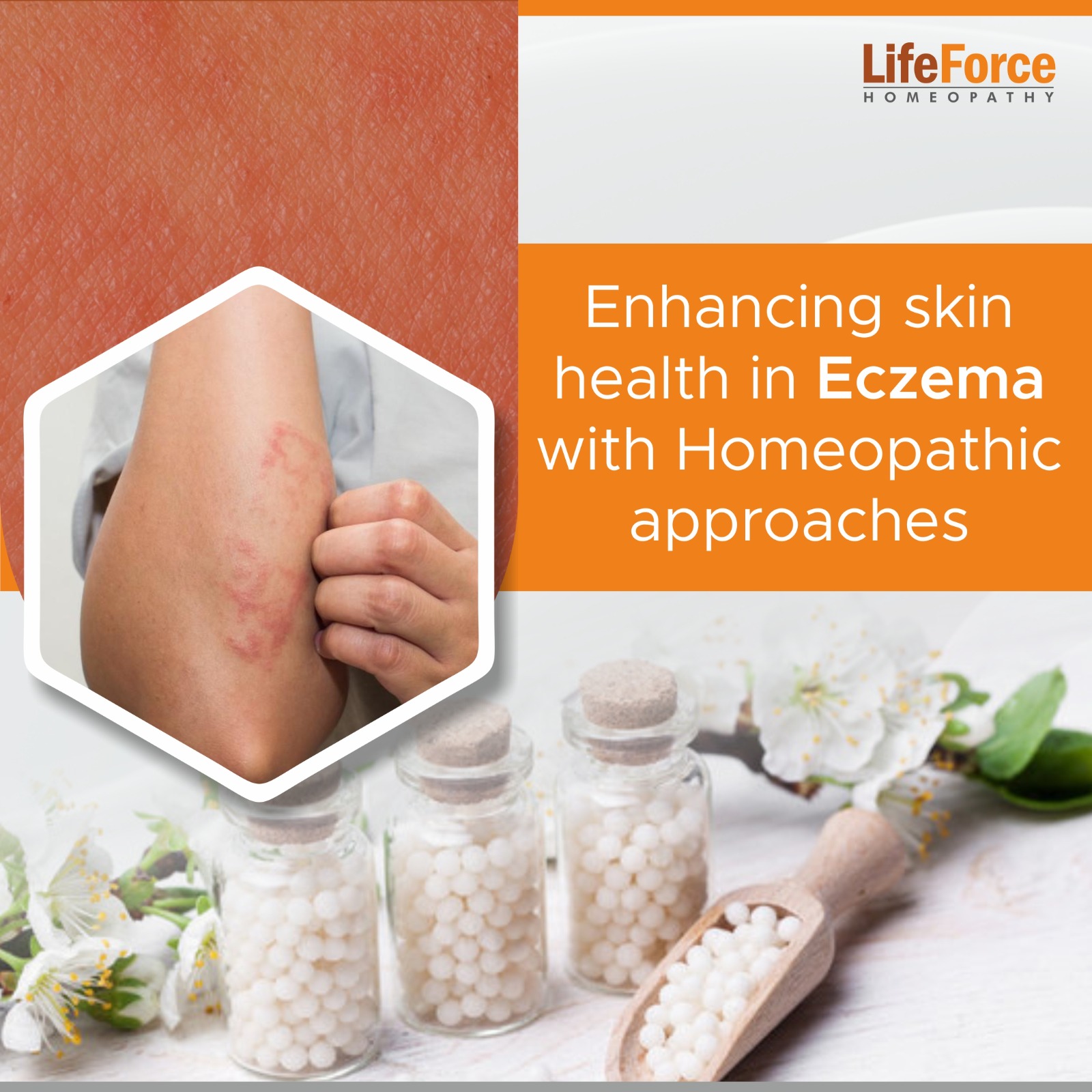 Enhancing skin health in Eczema with Homeopathic approaches