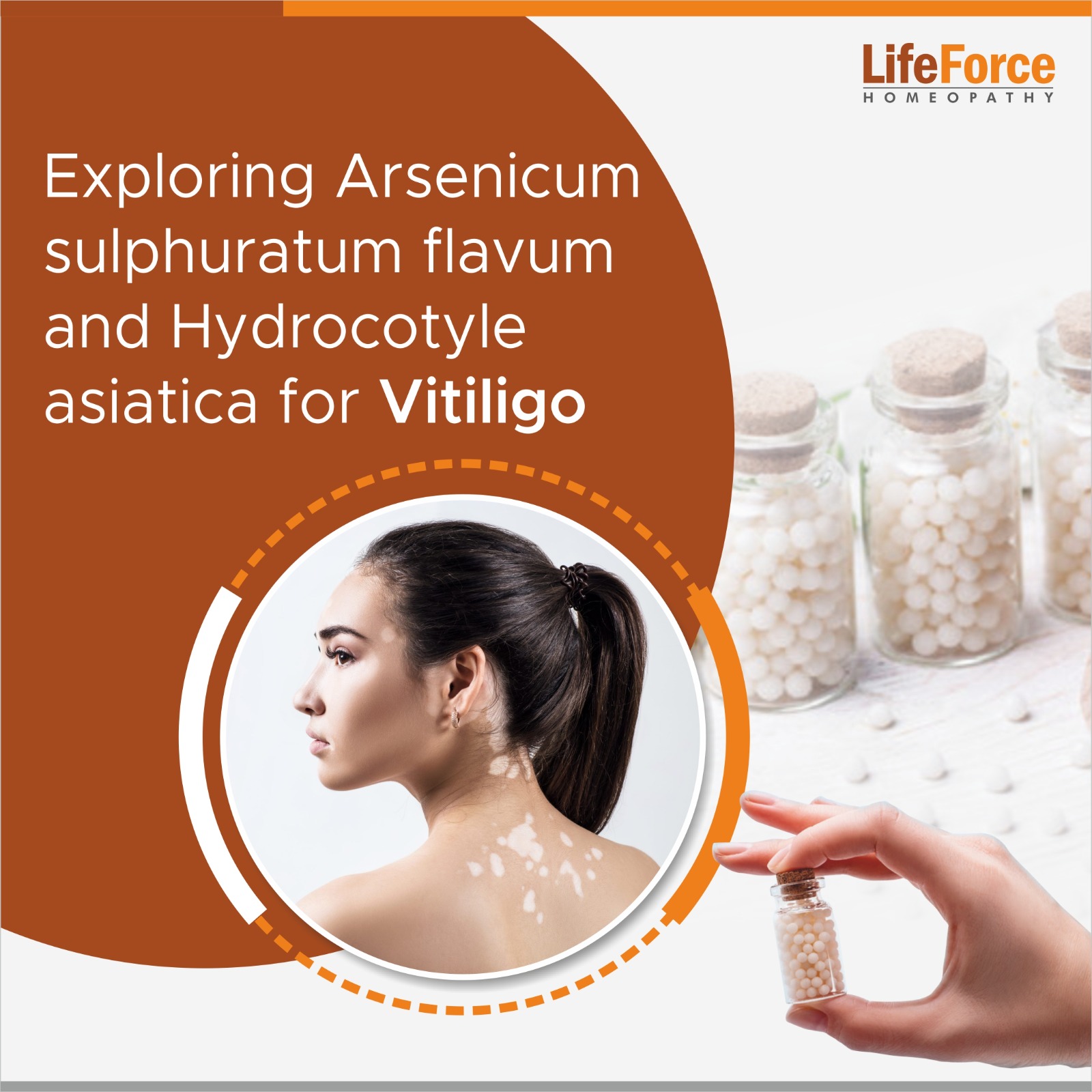 Exploring Arsenicum sulphuratum flavum and Hydrocotyle asiatica for Vitiligo