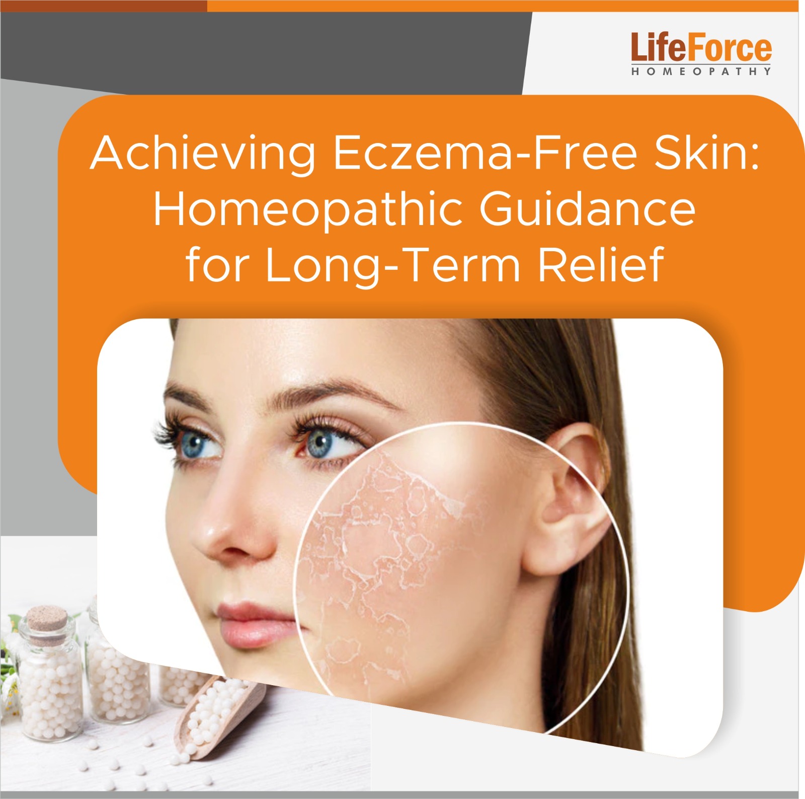 Achieving Eczema-Free Skin: Homeopathic Guidance for Long-Term Relief