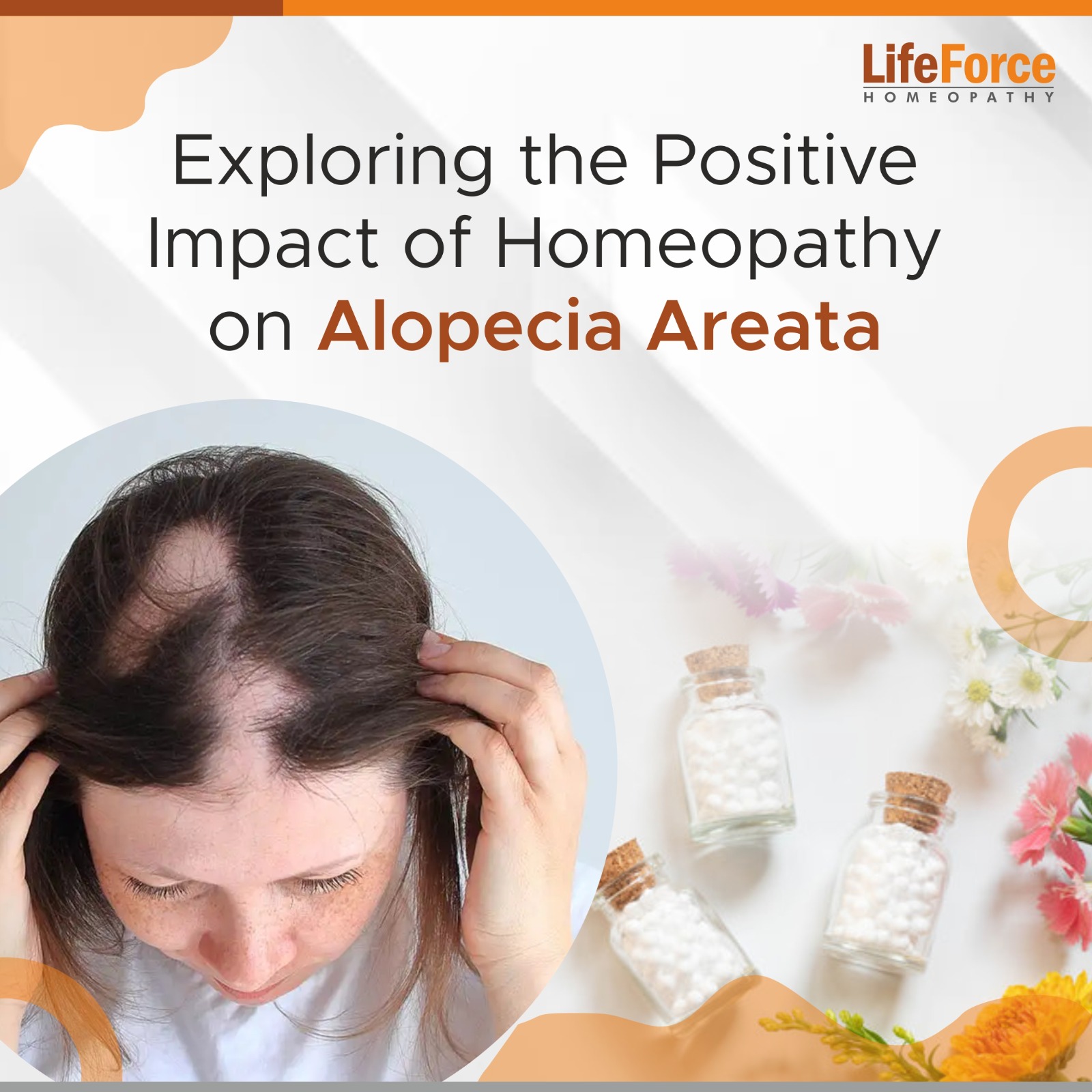 Exploring the Positive Impact of Homeopathy on Alopecia Areata