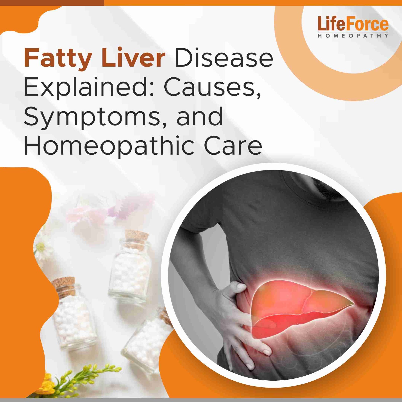 Fatty Liver Disease Explained: Causes, Symptoms, and Homeopathic Care