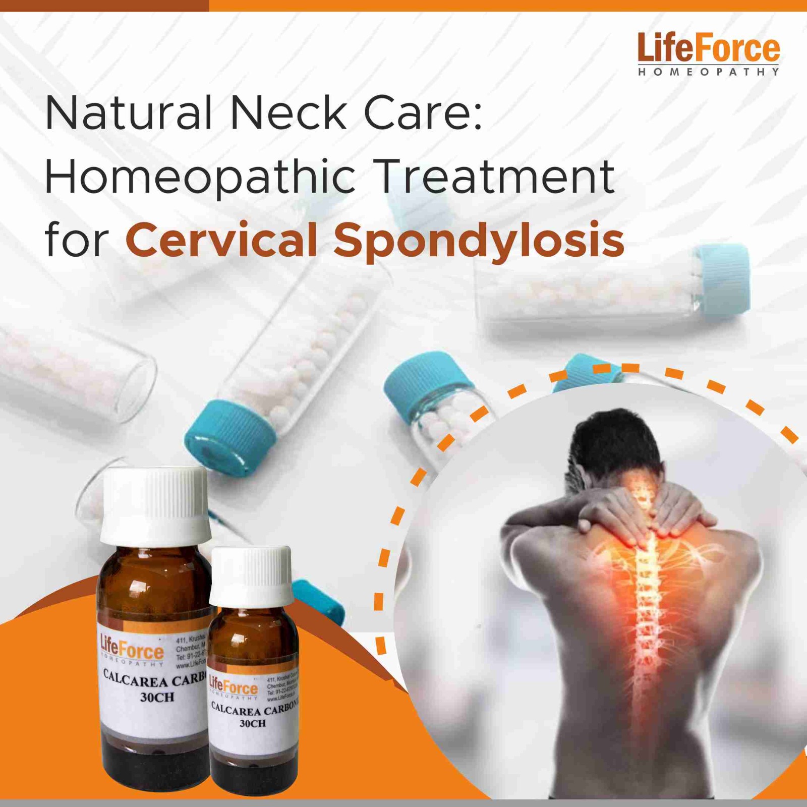 Natural Neck Care: Homeopathic Treatment for Cervical Spondylosis