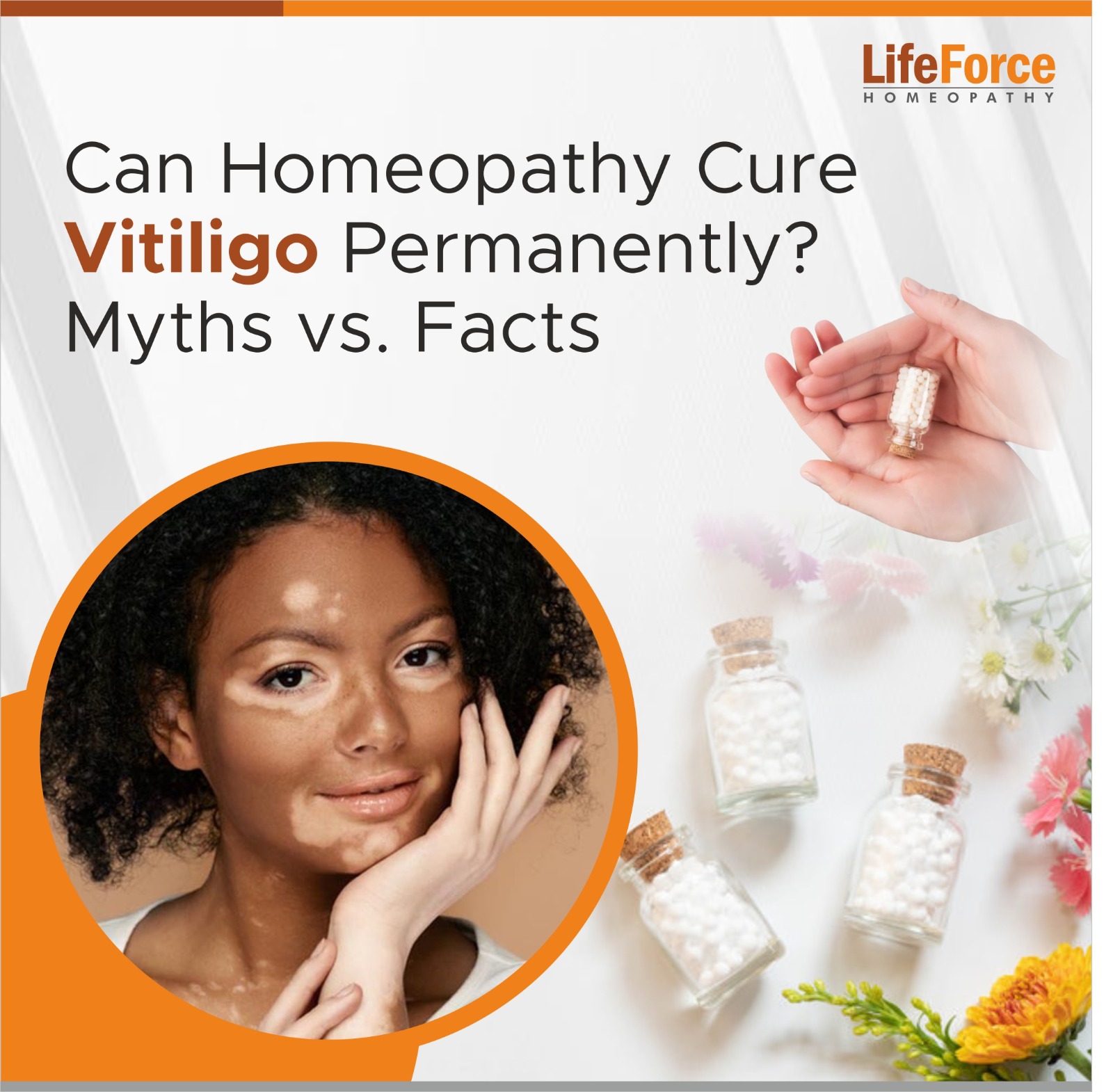 Can Homeopathy Cure Vitiligo Permanently? Myths vs. Facts