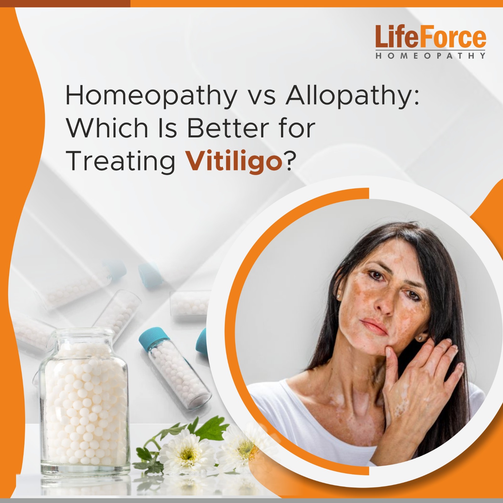 Homeopathy vs Allopathy: Which Is Better for Treating Vitiligo?