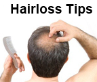 Hair Loss Prevention Tips for Men