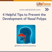 How To Break The Cycle Of Nasal Polyp Recurrence? | Lifeforce