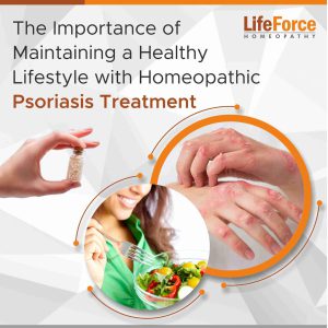 The Importance of Maintaining a Healthy Lifestyle with Homeopathic Psoriasis Treatment